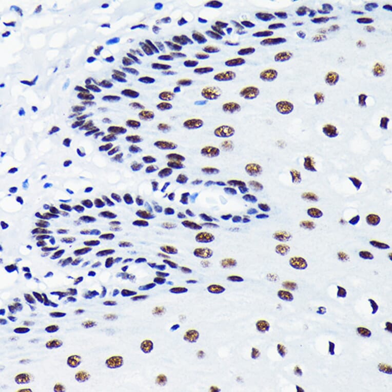 Immunohistochemistry - Anti-TDP43 Antibody [ARC0492] (A306079) - Antibodies.com