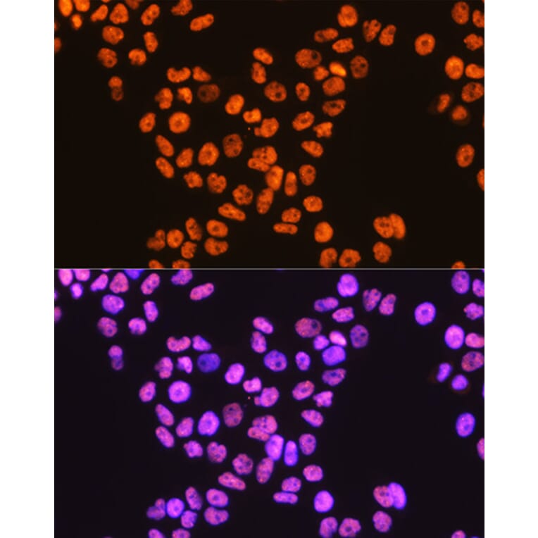 Immunofluorescence - Anti-TDP43 Antibody [ARC0492] (A306079) - Antibodies.com