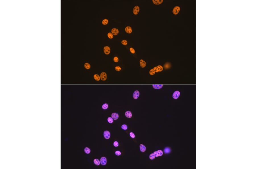 Immunofluorescence - Anti-TDP43 Antibody [ARC0492] (A306079) - Antibodies.com