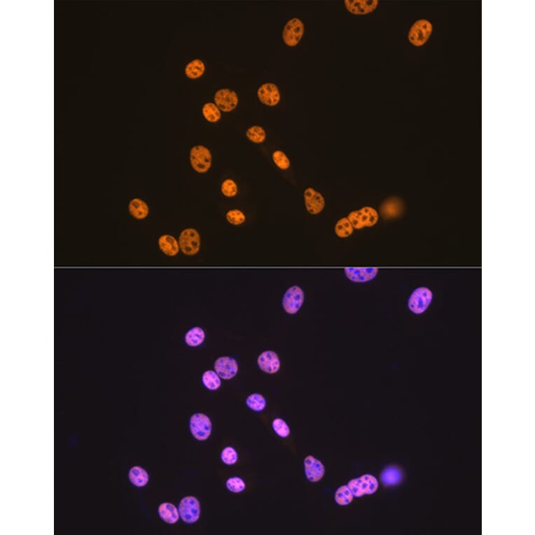 Immunofluorescence - Anti-TDP43 Antibody [ARC0492] (A306079) - Antibodies.com