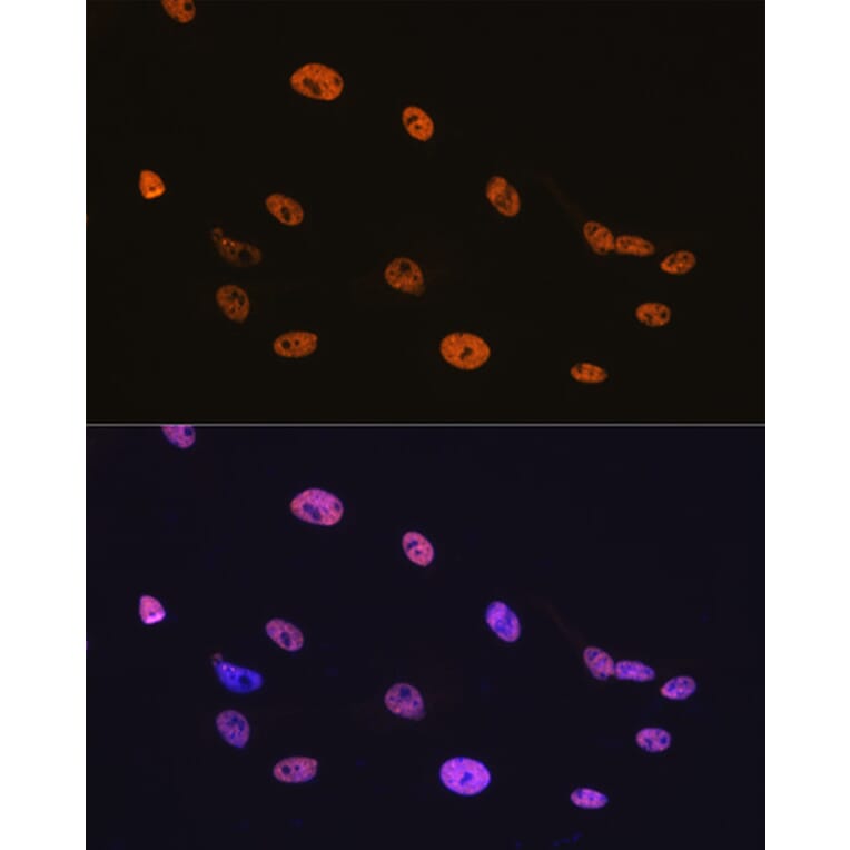 Immunofluorescence - Anti-TDP43 Antibody [ARC0492] (A306079) - Antibodies.com