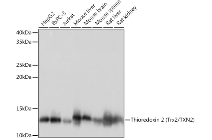 Western Blot - Anti-Thioredoxin 2 Antibody [ARC1003] (A306080) - Antibodies.com