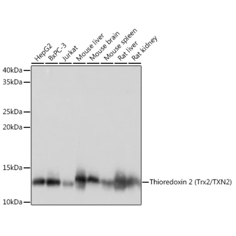 Western Blot - Anti-Thioredoxin 2 Antibody [ARC1003] (A306080) - Antibodies.com