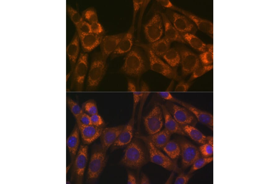 Immunofluorescence - Anti-Thioredoxin 2 Antibody [ARC1003] (A306080) - Antibodies.com