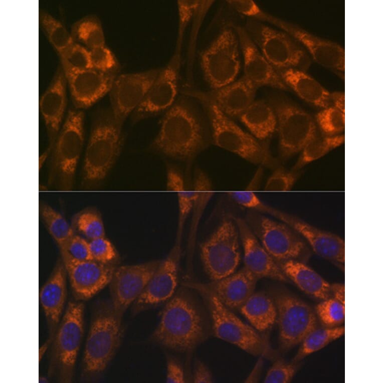 Immunofluorescence - Anti-Thioredoxin 2 Antibody [ARC1003] (A306080) - Antibodies.com