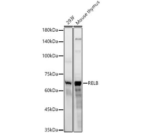 Western Blot - Anti-Rel B Antibody [ARC59947] (A306082) - Antibodies.com
