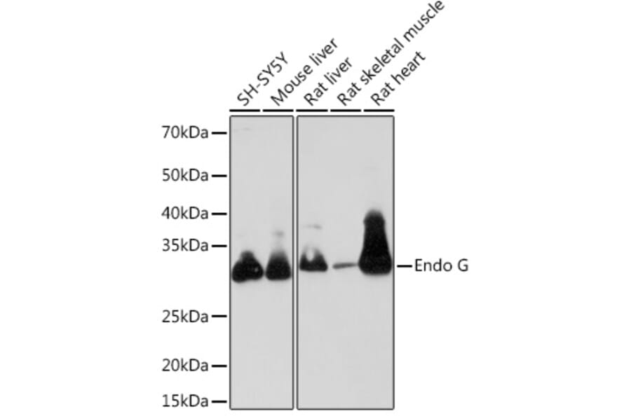 Western Blot - Anti-Endo G Antibody [ARC1308] (A306083) - Antibodies.com