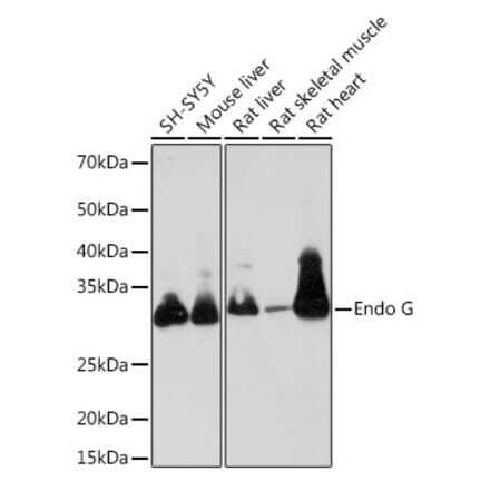 Western Blot - Anti-Endo G Antibody [ARC1308] (A306083) - Antibodies.com