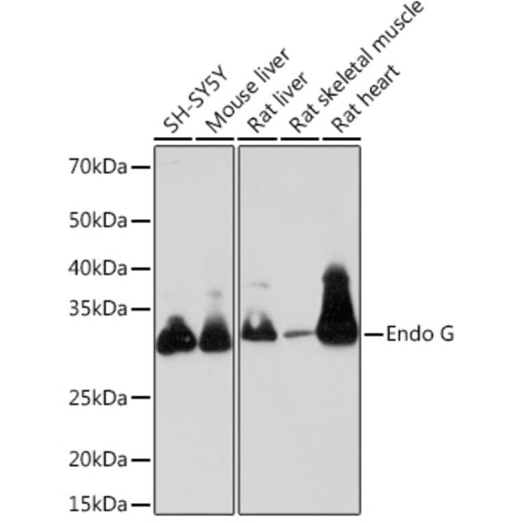 Western Blot - Anti-Endo G Antibody [ARC1308] (A306083) - Antibodies.com