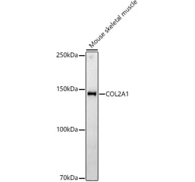 Western Blot - Anti-Collagen II Antibody (A306085) - Antibodies.com