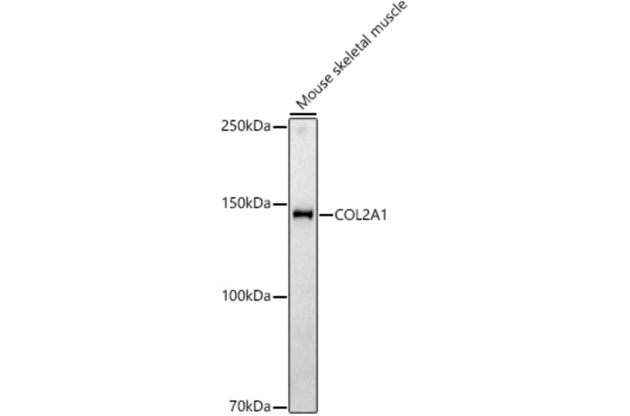 Western Blot - Anti-Collagen II Antibody (A306085) - Antibodies.com