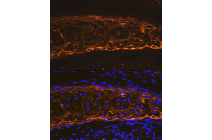 Immunofluorescence - Anti-Collagen II Antibody (A306085) - Antibodies.com