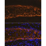 Immunofluorescence - Anti-Collagen II Antibody (A306085) - Antibodies.com