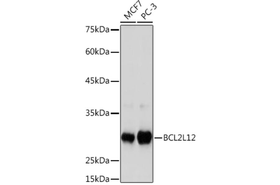 Western Blot - Anti-BPR Antibody [ARC2334] (A306086) - Antibodies.com