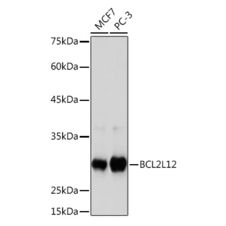 Western Blot - Anti-BPR Antibody [ARC2334] (A306086) - Antibodies.com