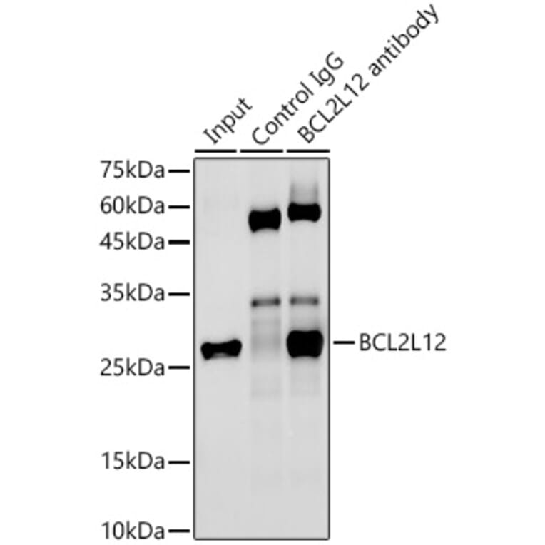 Western Blot - Anti-BPR Antibody [ARC2334] (A306086) - Antibodies.com