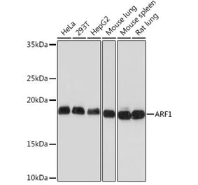 Western Blot - Anti-ARF1 Antibody [ARC1472] (A306088) - Antibodies.com