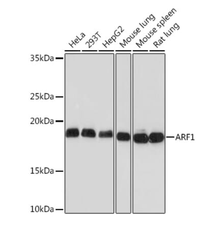 Western Blot - Anti-ARF1 Antibody [ARC1472] (A306088) - Antibodies.com