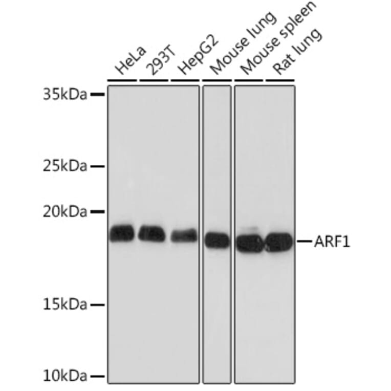 Western Blot - Anti-ARF1 Antibody [ARC1472] (A306088) - Antibodies.com