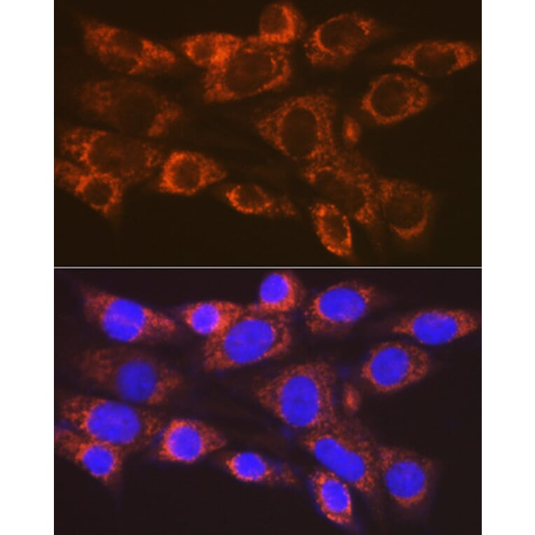 Immunofluorescence - Anti-ARF1 Antibody [ARC1472] (A306088) - Antibodies.com