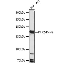 Western Blot - Anti-PKN2 Antibody (A306089) - Antibodies.com