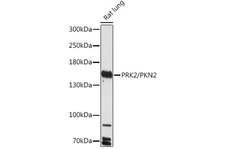 Western Blot - Anti-PKN2 Antibody (A306089) - Antibodies.com