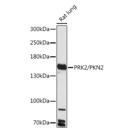 Western Blot - Anti-PKN2 Antibody (A306089) - Antibodies.com