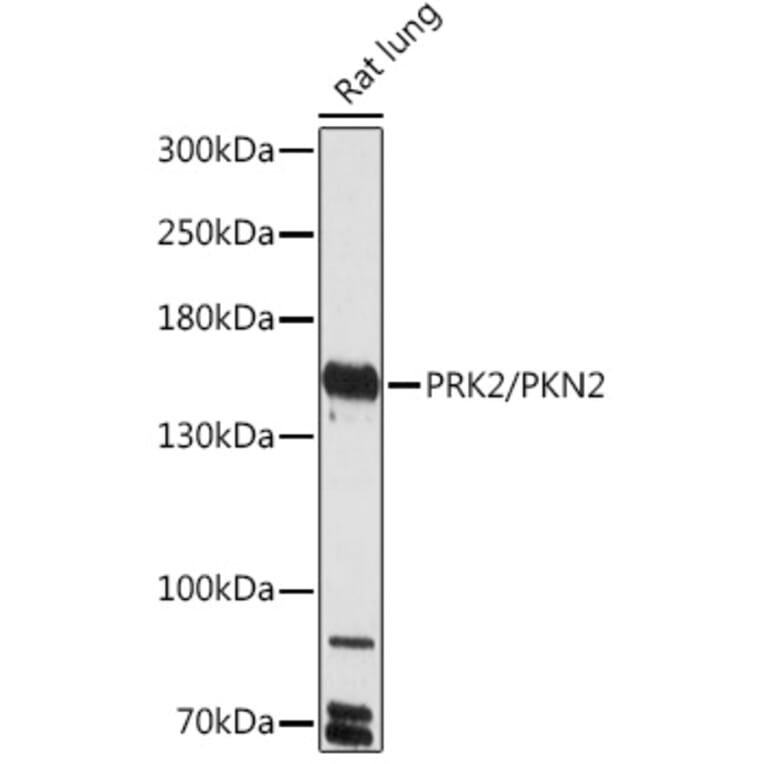 Western Blot - Anti-PKN2 Antibody (A306089) - Antibodies.com