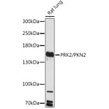 Western Blot - Anti-PKN2 Antibody (A306089) - Antibodies.com