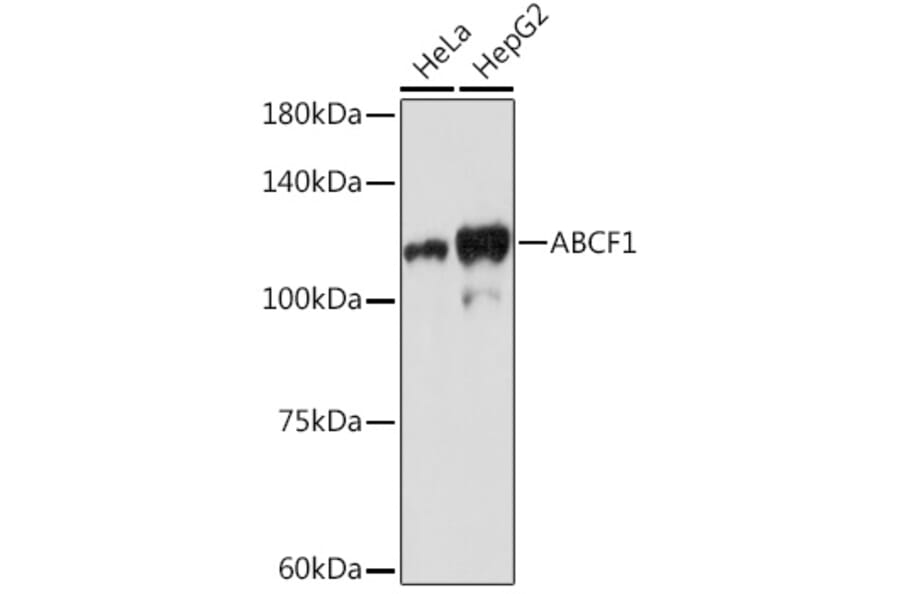 Western Blot - Anti-ABCF1 Antibody [ARC2199] (A306091) - Antibodies.com
