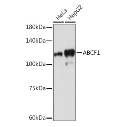 Western Blot - Anti-ABCF1 Antibody [ARC2199] (A306091) - Antibodies.com