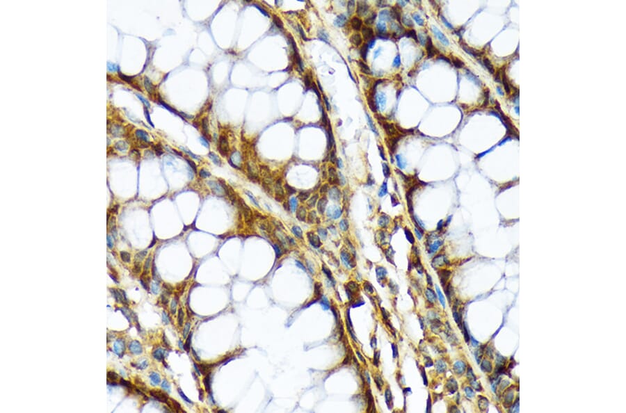 Immunohistochemistry - Anti-ABCF1 Antibody [ARC2199] (A306091) - Antibodies.com