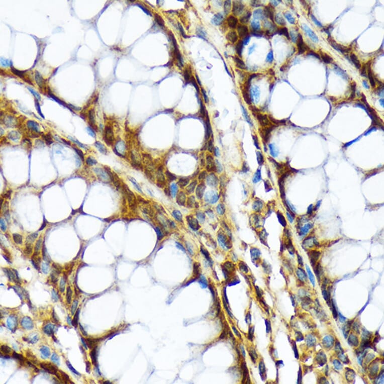 Immunohistochemistry - Anti-ABCF1 Antibody [ARC2199] (A306091) - Antibodies.com