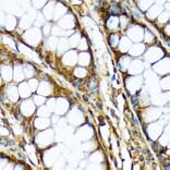 Immunohistochemistry - Anti-ABCF1 Antibody [ARC2199] (A306091) - Antibodies.com