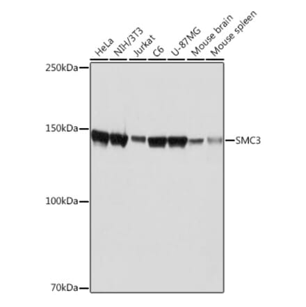 Western Blot - Anti-SMC3 Antibody [ARC2186] (A306092) - Antibodies.com