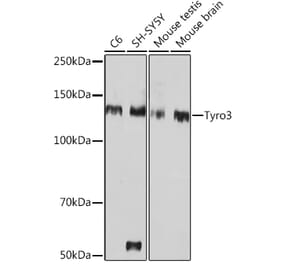 Western Blot - Anti-TYRO3 Antibody [ARC1841] (A306093) - Antibodies.com