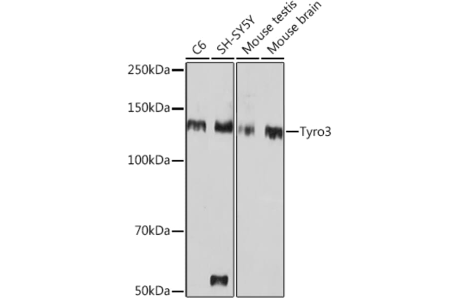 Western Blot - Anti-TYRO3 Antibody [ARC1841] (A306093) - Antibodies.com