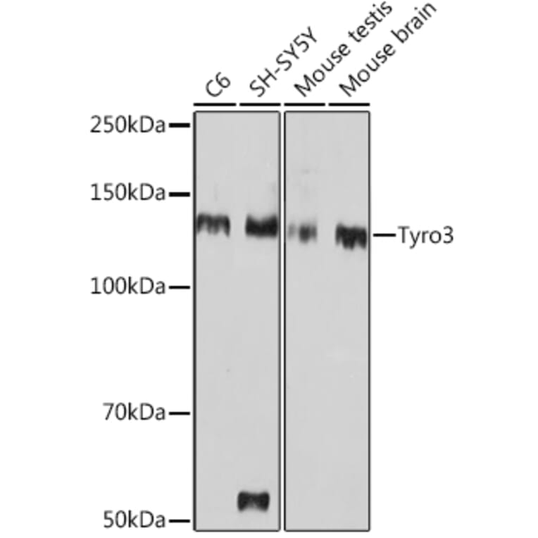 Western Blot - Anti-TYRO3 Antibody [ARC1841] (A306093) - Antibodies.com