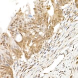 Immunohistochemistry - Anti-TAZ Antibody (A306094) - Antibodies.com