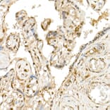 Immunohistochemistry - Anti-TAZ Antibody (A306094) - Antibodies.com