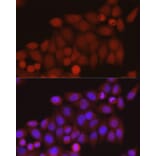 Immunofluorescence - Anti-TAZ Antibody (A306094) - Antibodies.com