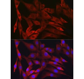 Immunofluorescence - Anti-IKK beta Antibody [ARC2632] (A306095) - Antibodies.com