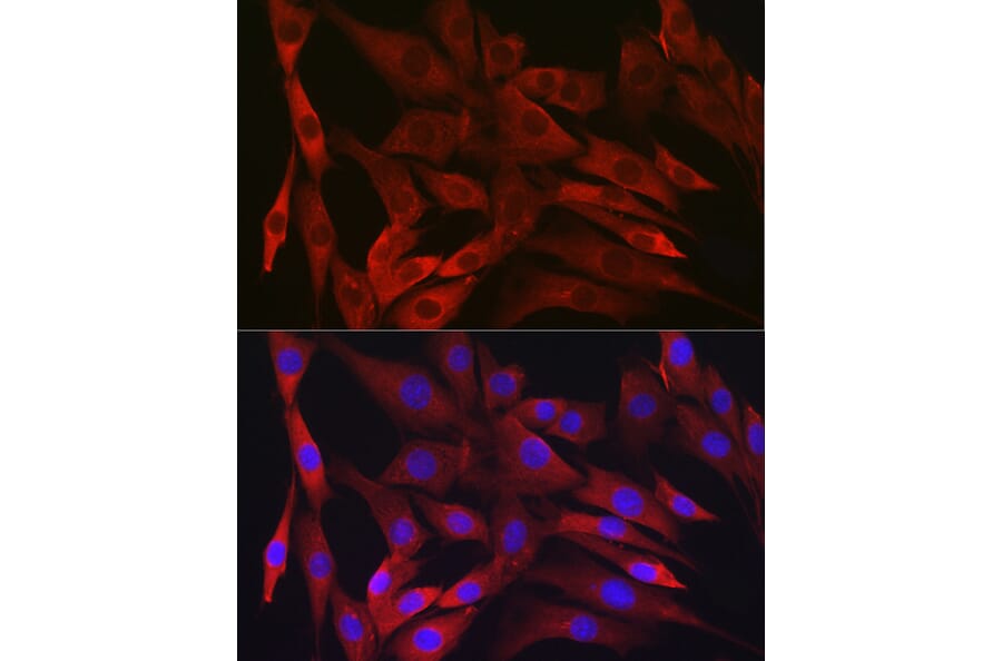 Immunofluorescence - Anti-IKK beta Antibody [ARC2632] (A306095) - Antibodies.com