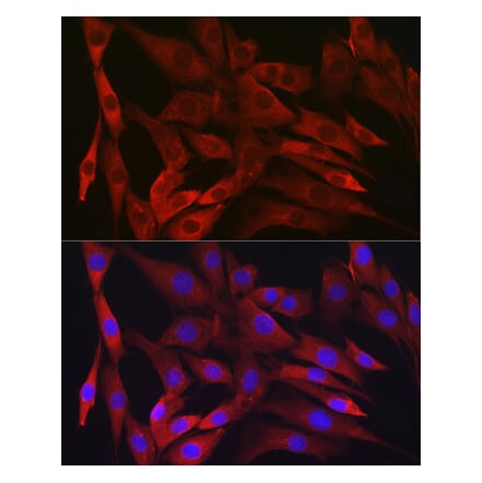 Immunofluorescence - Anti-IKK beta Antibody [ARC2632] (A306095) - Antibodies.com