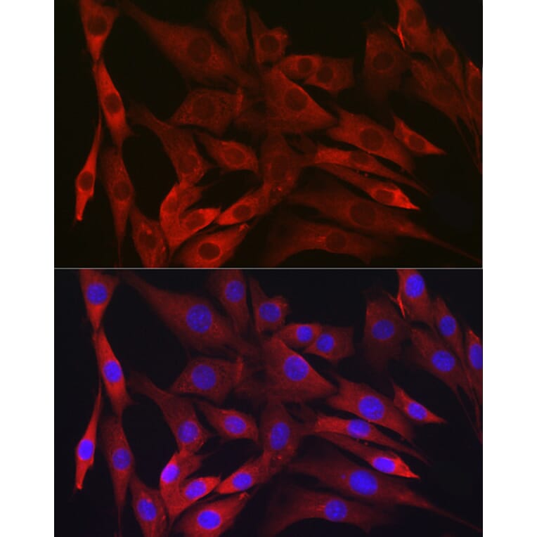 Immunofluorescence - Anti-IKK beta Antibody [ARC2632] (A306095) - Antibodies.com