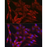 Immunofluorescence - Anti-IKK beta Antibody [ARC2632] (A306095) - Antibodies.com