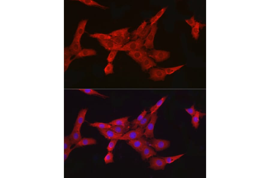 Immunofluorescence - Anti-IKK beta Antibody [ARC2632] (A306095) - Antibodies.com