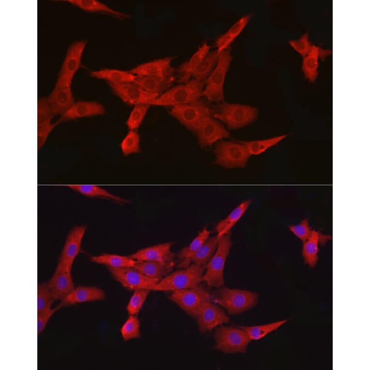 Immunofluorescence - Anti-IKK beta Antibody [ARC2632] (A306095) - Antibodies.com