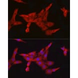 Immunofluorescence - Anti-IKK beta Antibody [ARC2632] (A306095) - Antibodies.com