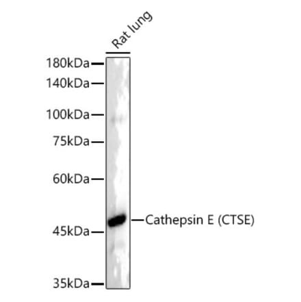 Western Blot - Anti-Cathepsin E Antibody [ARC55299] (A306096) - Antibodies.com